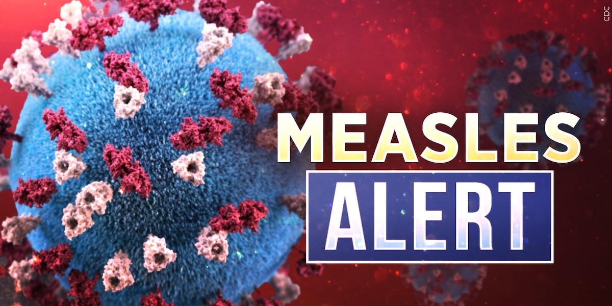 Measles detected in Western Iowa resident Measles detected in Western Iowa resident