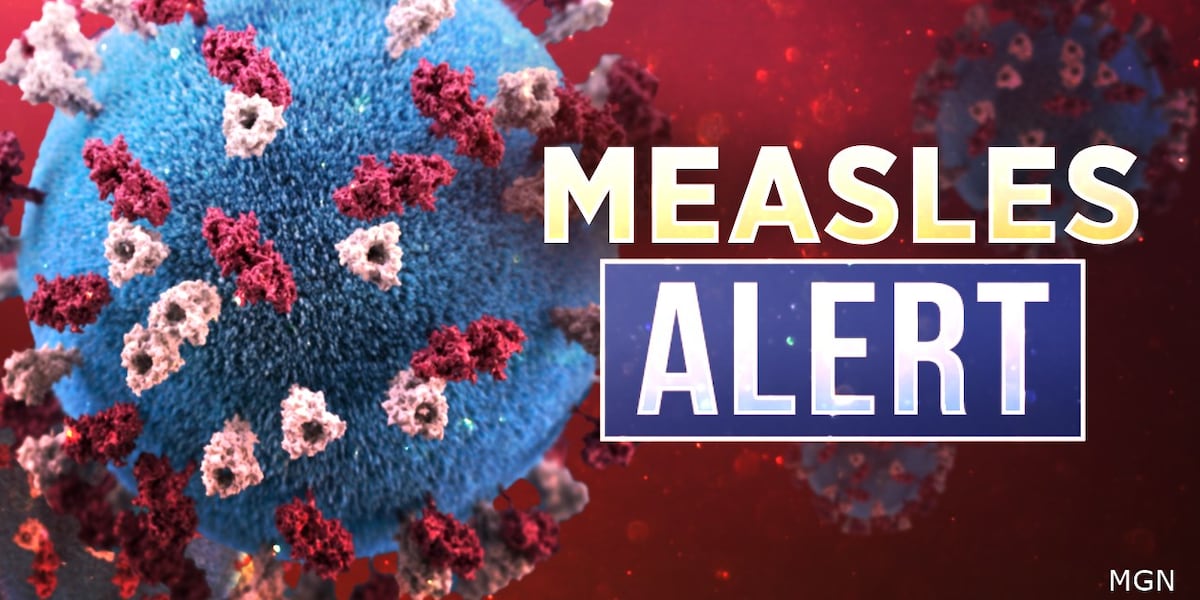 First measles case confirmed in South Dakota