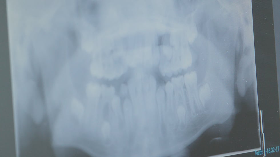 Dr. Kuiper says it's ideal to keep up with preventative dental care at a young age because...